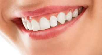 Rahasia Menghilangkan Karang Gigi Tanpa Ribet: Manfaat Luar Biasa dari Bahan Dapur